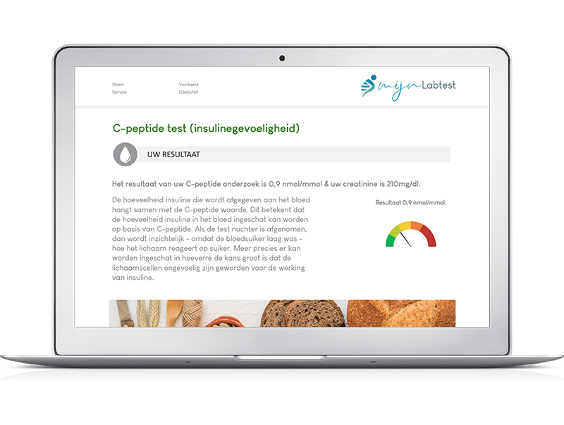 Het testresultaat geeft meer informatie over insulineresistentie. Het testresultaat geeft meer informatie over insulineresistentie.