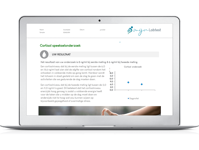 Cortisol onderzoek hormonen speekseltest vrouw 