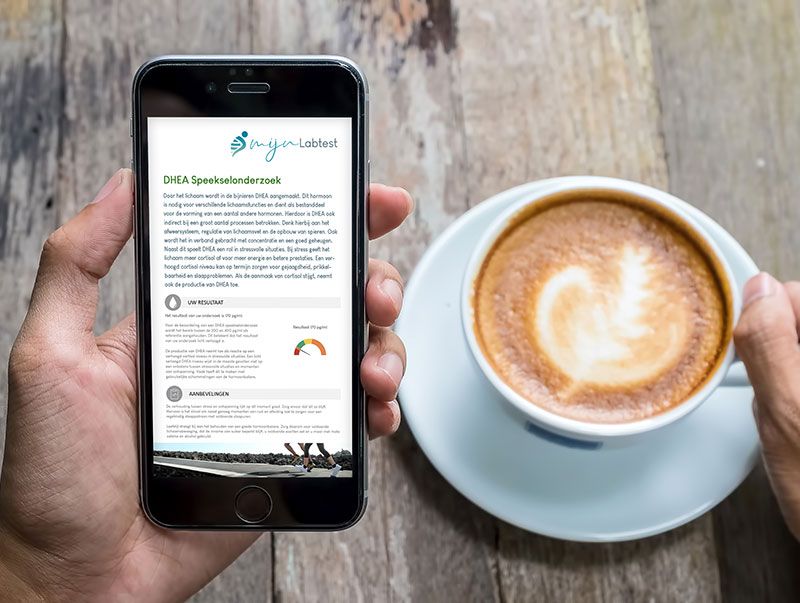 De uitslag van je cortisol DHEA test is eenvoudig vanaf elk device af te lezen. De uitslag van je cortisol DHEA test is eenvoudig vanaf elk device af te lezen.