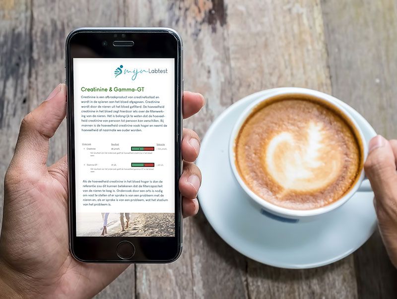 De uitslag van een lever test op mobiel De uitslag van een lever test op mobiel