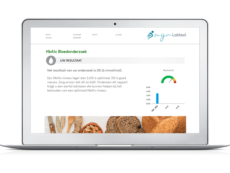 Het resultaat van de totaal profiel XL bloedtest - Dit rapport geeft inzicht en tips voor de actuele gezondheid 