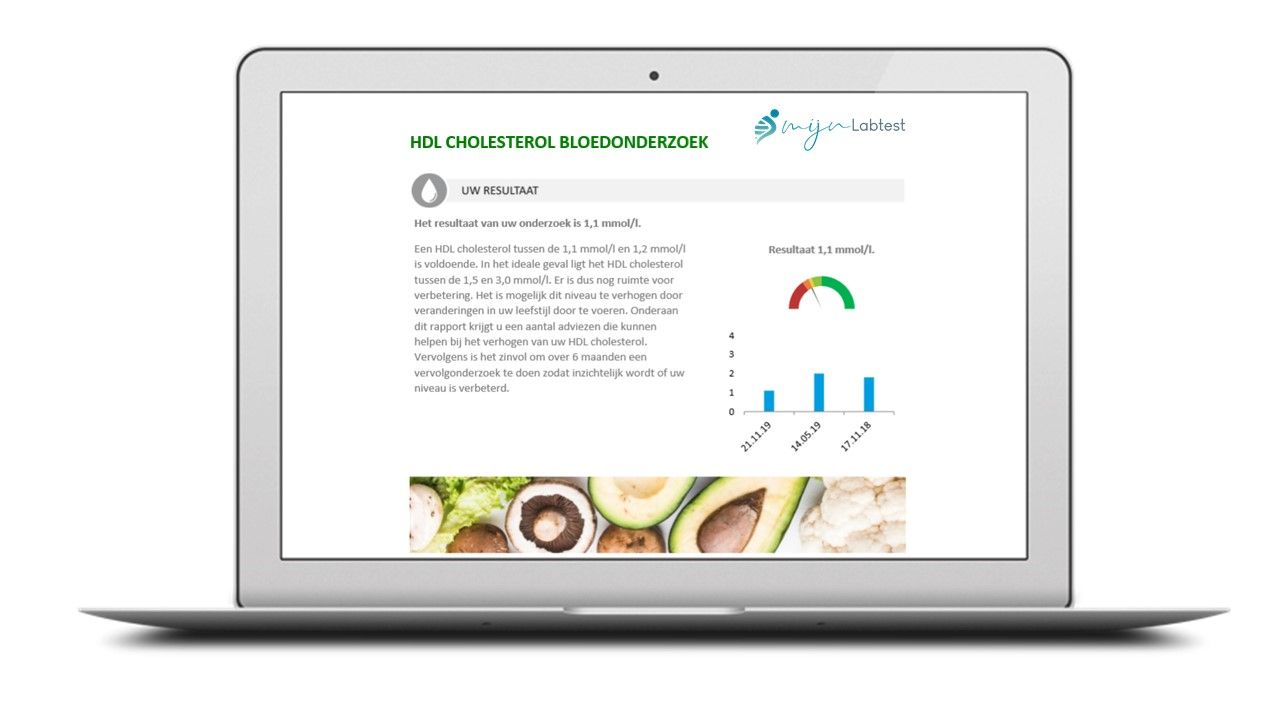 Het resultaat na een cholesterol thuistest