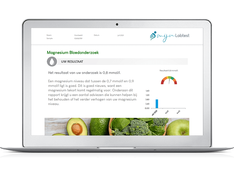 Voorbeeldrapport bloedtest magnesium tekort - Na de test kun je direct aan de slag met uitleg en tips uit het rapport Voorbeeldrapport bloedtest magnesium tekort - Na de test kun je direct aan de slag met uitleg en tips uit het rapport