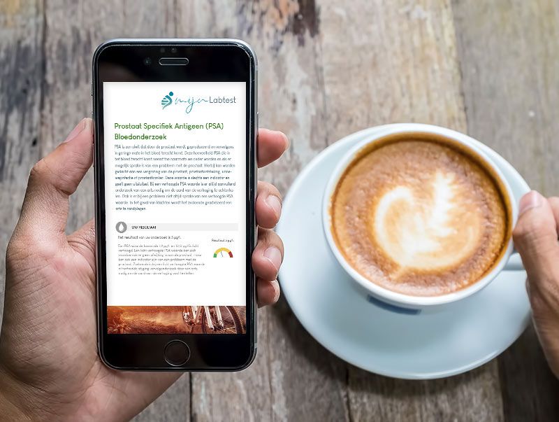De uitslag van het zelftest PSA is eenvoudig af te lezen vanaf elk device. De uitslag van het zelftest PSA is eenvoudig af te lezen vanaf elk device.