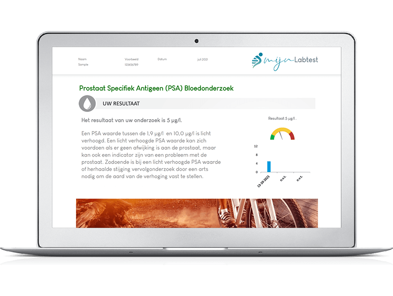 Voorbeeldrapport PSA zelftest - Na de test kun je direct aan de slag met uitleg en tips uit het rapport Voorbeeldrapport PSA zelftest - Na de test kun je direct aan de slag met uitleg en tips uit het rapport