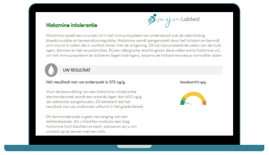 Zo ziet de uitslag van een histamine-intolerantie test eruit. Zo ziet de uitslag van een histamine-intolerantie test eruit.