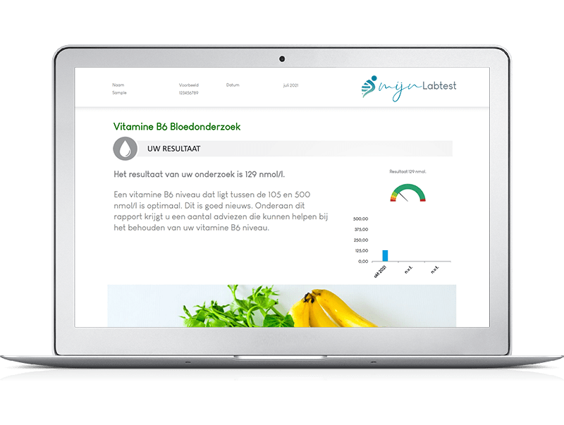 voorbeeld rapport vegetariër profiel bloedtest voorbeeld rapport vegetariër profiel bloedtest