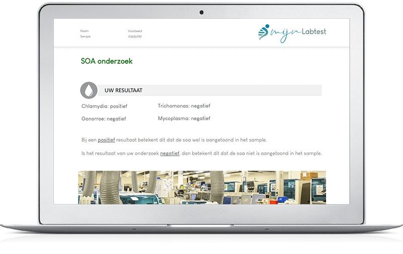 Betrouwbare soa test