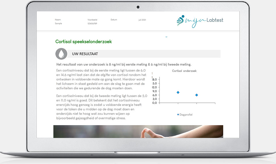 Cortisol test uitslag