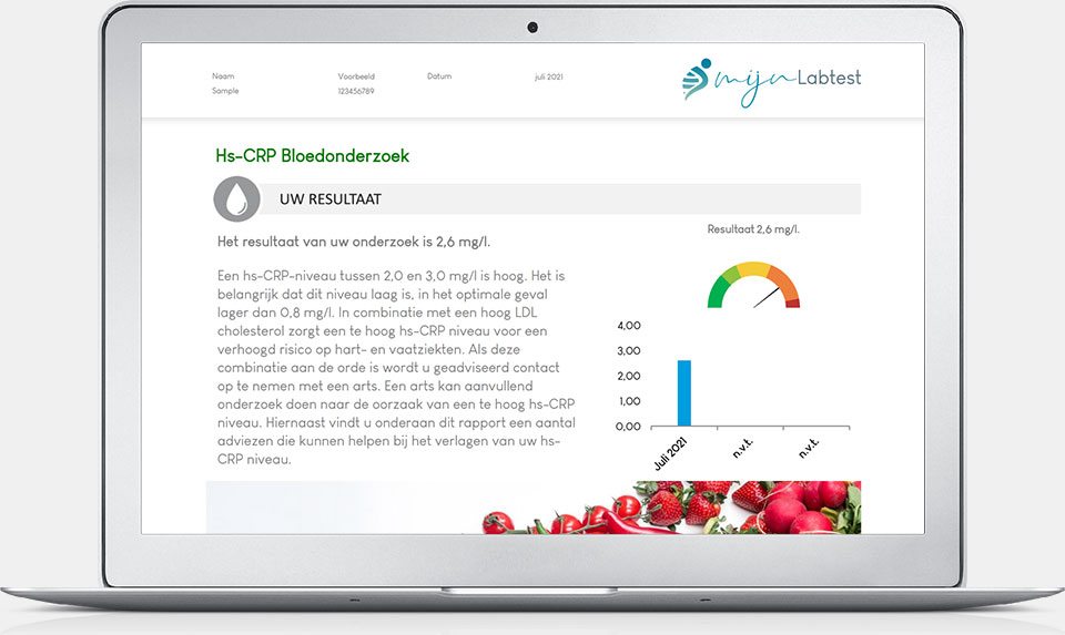 CRP waarde test uitslag