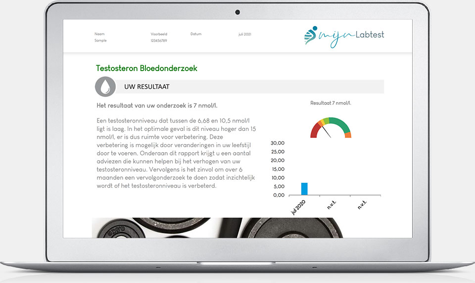 Testosteron test uitslag