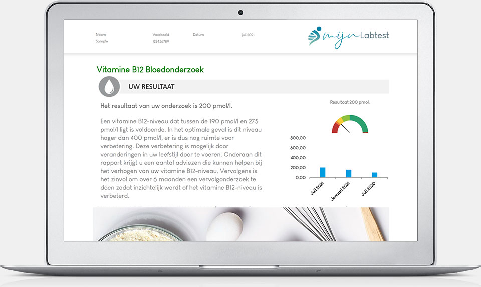 Vitamine B12 test uitslag